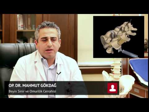 Mikrodiskektomi Nedir? - Op. Dr. Mahmut Gökdağ