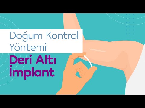 Deri Altı İmplant Nedir? Nasıl Takılır? Deri Altı İmplantın Avantajları ve Dezavantajları