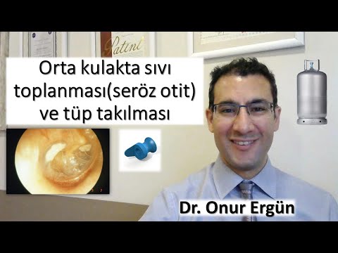Orta kulakta sıvı birikmesi(seröz otit) ve tüp takılması