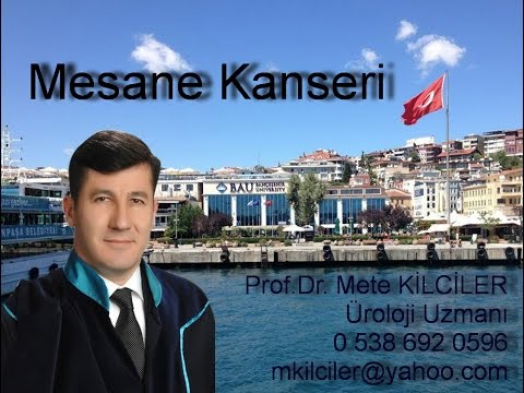 Mesane Kanseri / Mesane Tümörleri ve Sigara