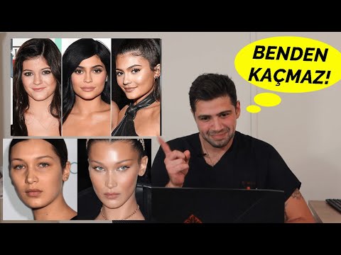 PLASTİK CERRAHA, ÜNLÜLERİN ESTETİK AMELİYATLARINI SORDUM , BİLEMEDİĞİ OLDU MU?