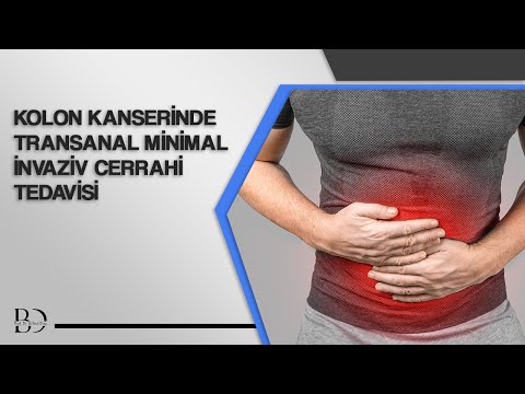Kolon Kanserinde Transanal Minimal İnvaziv Cerrahi Tedavisi | Prof. Dr. Bülent Dinç